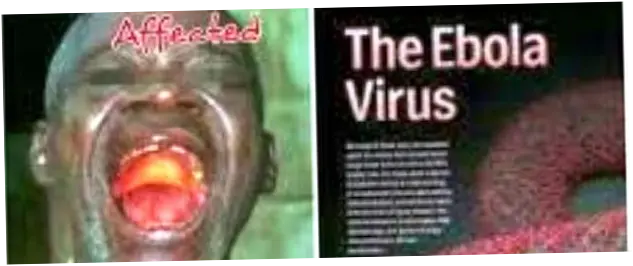 Ebola dan Pembangunan: Dua Wajah 808